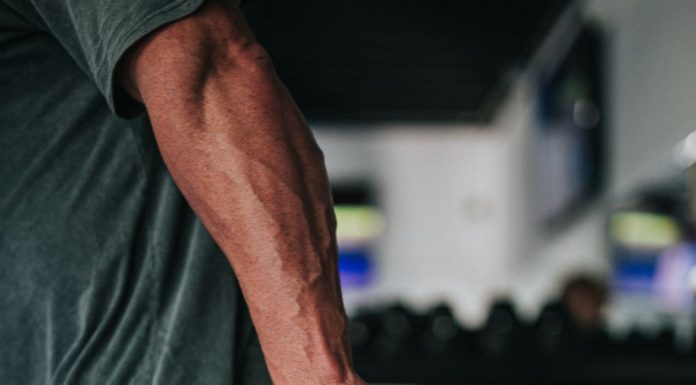 NAD+ and Aging Muscles